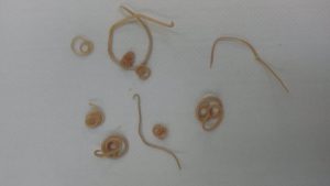 Roundworm examples